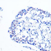 Anti-Monoamine Oxidase B (MAOB) antibody produced in rabbit
