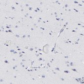 Anti-ZAP70 antibody produced in rabbit Prestige Antibodies&#174; Powered by Atlas Antibodies, affinity isolated antibody, buffered aqueous glycerol solution