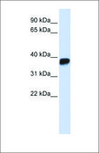 Anti-LDHA antibody produced in rabbit affinity isolated antibody