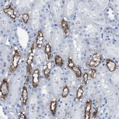 Anti-SLC12A1 antibody produced in rabbit Prestige Antibodies&#174; Powered by Atlas Antibodies, affinity isolated antibody, buffered aqueous glycerol solution