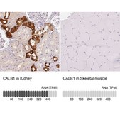 Anti-CALB1 antibody produced in rabbit Prestige Antibodies&#174; Powered by Atlas Antibodies, affinity isolated antibody, buffered aqueous glycerol solution