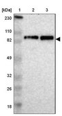 Anti-KIF2A antibody produced in rabbit Prestige Antibodies&#174; Powered by Atlas Antibodies, affinity isolated antibody, buffered aqueous glycerol solution