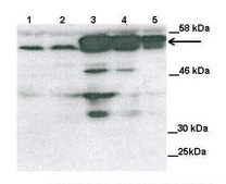 Anti-STK3 antibody produced in rabbit affinity isolated antibody