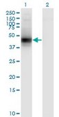 Monoclonal Anti-DCN antibody produced in mouse clone 3H4-1F4, purified immunoglobulin, buffered aqueous solution