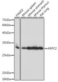 Anti-ARPC2 Antibody, clone 4F2G6, Rabbit Monoclonal