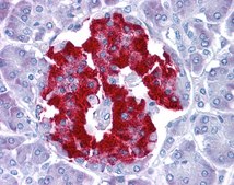 Anti-PRDM1 antibody produced in rabbit affinity isolated antibody