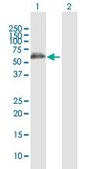 Anti-ALDH4A1 antibody produced in rabbit purified immunoglobulin, buffered aqueous solution