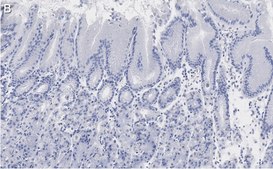 Anti-MYO1C Antibody, clone 4B19, ZooMAb&#174; Rabbit Monoclonal recombinant, expressed in HEK 293 cells
