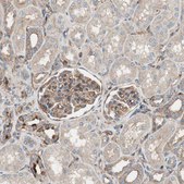 Anti-IL1RL1 antibody produced in rabbit Prestige Antibodies&#174; Powered by Atlas Antibodies, affinity isolated antibody, buffered aqueous glycerol solution