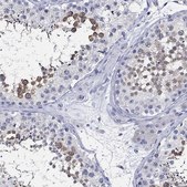 Anti-CETN1 antibody produced in rabbit Prestige Antibodies&#174; Powered by Atlas Antibodies, affinity isolated antibody, buffered aqueous glycerol solution