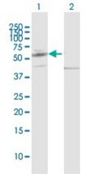 Anti-PPAT antibody produced in rabbit purified immunoglobulin, buffered aqueous solution