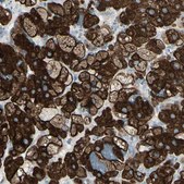 Anti-FRMD5 antibody produced in rabbit Ab1, Prestige Antibodies&#174; Powered by Atlas Antibodies, affinity isolated antibody, buffered aqueous glycerol solution