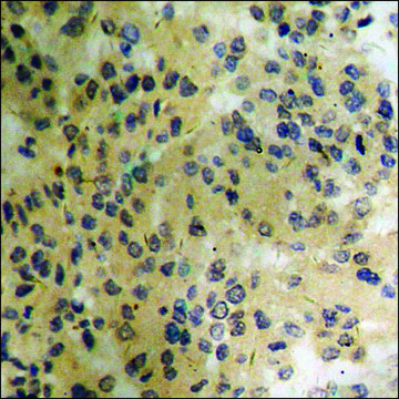 Anti-phospho-Myc (pThr358) antibody produced in rabbit affinity isolated antibody
