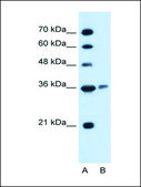 Anti-ARG1 (AB2) antibody produced in rabbit IgG fraction of antiserum