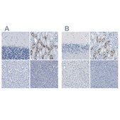 Anti-SLC12A1 antibody produced in rabbit Prestige Antibodies&#174; Powered by Atlas Antibodies, affinity isolated antibody, buffered aqueous glycerol solution