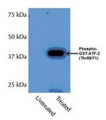 SAPK Pathway Explorer Antibody Minipack Upstate&#174;