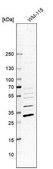 Anti-TPMT antibody produced in rabbit Prestige Antibodies&#174; Powered by Atlas Antibodies, affinity isolated antibody, buffered aqueous glycerol solution