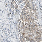 Anti-OCLN antibody produced in rabbit Prestige Antibodies&#174; Powered by Atlas Antibodies, affinity isolated antibody, buffered aqueous glycerol solution