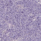 Anti-CES2 antibody produced in rabbit Prestige Antibodies&#174; Powered by Atlas Antibodies, affinity isolated antibody, buffered aqueous glycerol solution
