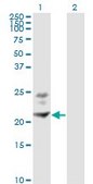Monoclonal Anti-BST2, (C-terminal) antibody produced in mouse clone 3H4, purified immunoglobulin, buffered aqueous solution