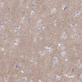 Anti-SYT12 antibody produced in rabbit Prestige Antibodies&#174; Powered by Atlas Antibodies, affinity isolated antibody, buffered aqueous glycerol solution
