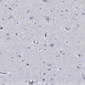 Anti-ITGAE antibody produced in rabbit Prestige Antibodies&#174; Powered by Atlas Antibodies, affinity isolated antibody, buffered aqueous glycerol solution