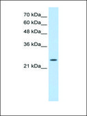 Anti-TNNI1 (AB1) antibody produced in rabbit affinity isolated antibody