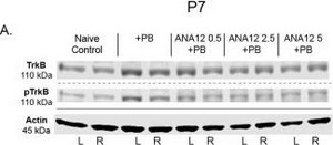 Anti-phospho-TrkB (Tyr816) Antibody from rabbit, purified by affinity chromatography