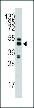 ANTI-S ADENOSYLHOMOCYSTEINE HYDROLASE (ACHY)(C-TERMINAL) antibody produced in rabbit purified immunoglobulin, buffered aqueous solution