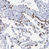 Anti-SFTPC antibody produced in rabbit Prestige Antibodies&#174; Powered by Atlas Antibodies, affinity isolated antibody, buffered aqueous glycerol solution, Ab1