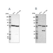 Anti-G6PD antibody produced in rabbit Ab2, Prestige Antibodies&#174; Powered by Atlas Antibodies, affinity isolated antibody, buffered aqueous glycerol solution