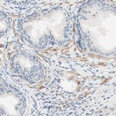 Anti-JPH1 antibody produced in rabbit Ab1, Prestige Antibodies&#174; Powered by Atlas Antibodies, affinity isolated antibody, buffered aqueous glycerol solution