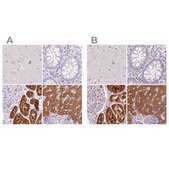 Anti-FTCD antibody produced in rabbit Prestige Antibodies&#174; Powered by Atlas Antibodies, affinity isolated antibody, buffered aqueous glycerol solution