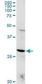Anti-POMC antibody produced in rabbit purified immunoglobulin, buffered aqueous solution