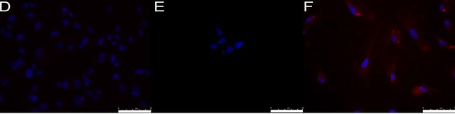 Anti-Stage-Specific Embryonic Antigen-1 Antibody, clone MC-480 clone MC-480, Chemicon&#174;, from mouse