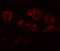 Anti-DPAGT1 antibody produced in rabbit affinity isolated antibody