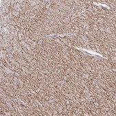 Anti-GABBR2 antibody produced in rabbit Prestige Antibodies&#174; Powered by Atlas Antibodies, affinity isolated antibody, buffered aqueous glycerol solution