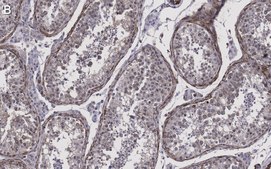 Anti-Pericentrin Antibody, clone 2H11, ZooMAb&#174; Rabbit Monoclonal recombinant, expressed in HEK 293 cells