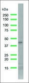 Anti-SMA antibody, Rabbit monoclonal recombinant, expressed in proprietary host, clone SP171, affinity isolated antibody