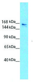 Anti-SLIT3, (N-terminal) antibody produced in rabbit affinity isolated antibody