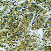 Anti-phospho-mTOR (pSer2448) antibody produced in rabbit affinity isolated antibody