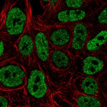 Anti-Mapk10 Antibody Produced In Rabbit Prestige Antibodies&#174; Powered by Atlas Antibodies, affinity isolated antibody, buffered aqueous glycerol solution