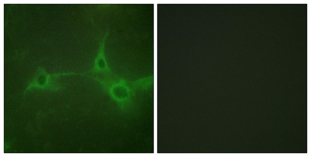Anti-ADAM 17, C-Terminal antibody produced in rabbit affinity isolated antibody