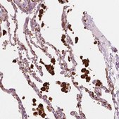 Anti-CES1 antibody produced in rabbit Prestige Antibodies® Powered by Atlas Antibodies, affinity isolated antibody, buffered aqueous glycerol solution