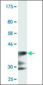 Monoclonal Anti-LRP5 antibody produced in mouse clone 1E9, ascites fluid