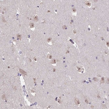 Anti-SENP3 antibody produced in rabbit Prestige Antibodies&#174; Powered by Atlas Antibodies, affinity isolated antibody, buffered aqueous glycerol solution