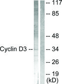 Anti-Cyclin D3 antibody produced in rabbit affinity isolated antibody