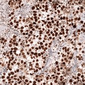 Monoclonal Anti-Msh2 Antibody Produced In Mouse Prestige Antibodies&#174; Powered by Atlas Antibodies, clone CL13713, affinity isolated antibody, buffered aqueous glycerol solution