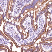 Anti-ACAA2 antibody produced in rabbit Prestige Antibodies&#174; Powered by Atlas Antibodies, affinity isolated antibody, buffered aqueous glycerol solution