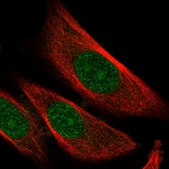 Anti-SKP2 antibody produced in rabbit Prestige Antibodies&#174; Powered by Atlas Antibodies, affinity isolated antibody